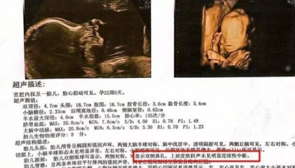 桂林女子称彩超漏诊婴儿唇裂，到卫健委反映问题竟遭怒斥，涉事医院：彩超未看出任何问题