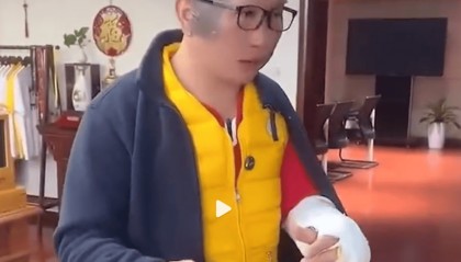 周黑鸭创始人突遇爆炸！脸部和手臂被炸伤，本人呼吁：大家一定要买正规牌子