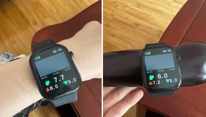 绑在茄子上也能显示血糖值！智能手表“无创测血糖”靠谱吗？