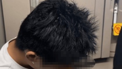 19岁少年飞机上突发剧烈头痛和面部麻木，医生万米高空针灸施救，婉拒家属红包