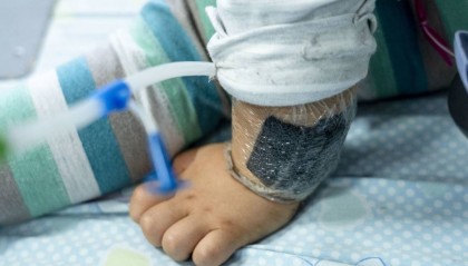 可瞬间产生近100℃高温！合肥医生发出提醒